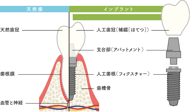 治療イラスト